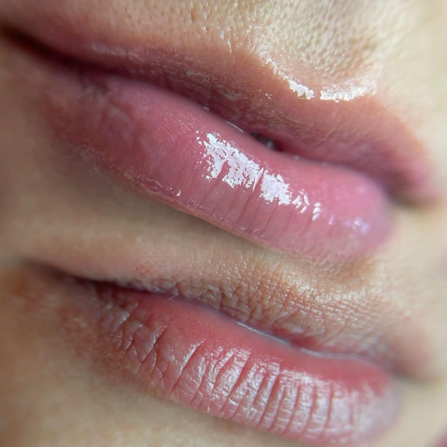 Hydra Gloss Lips + Epilação Do Buço