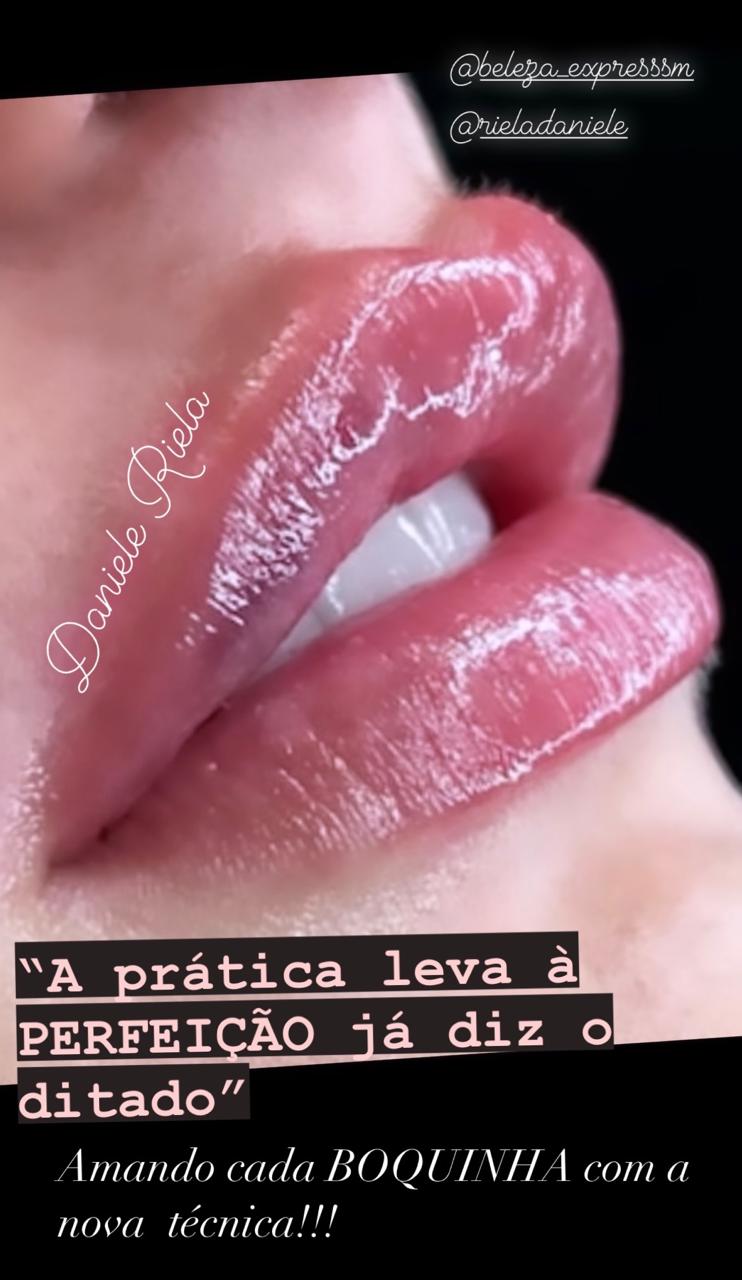 Prenchimento Labial Com Técnica Natural Lips