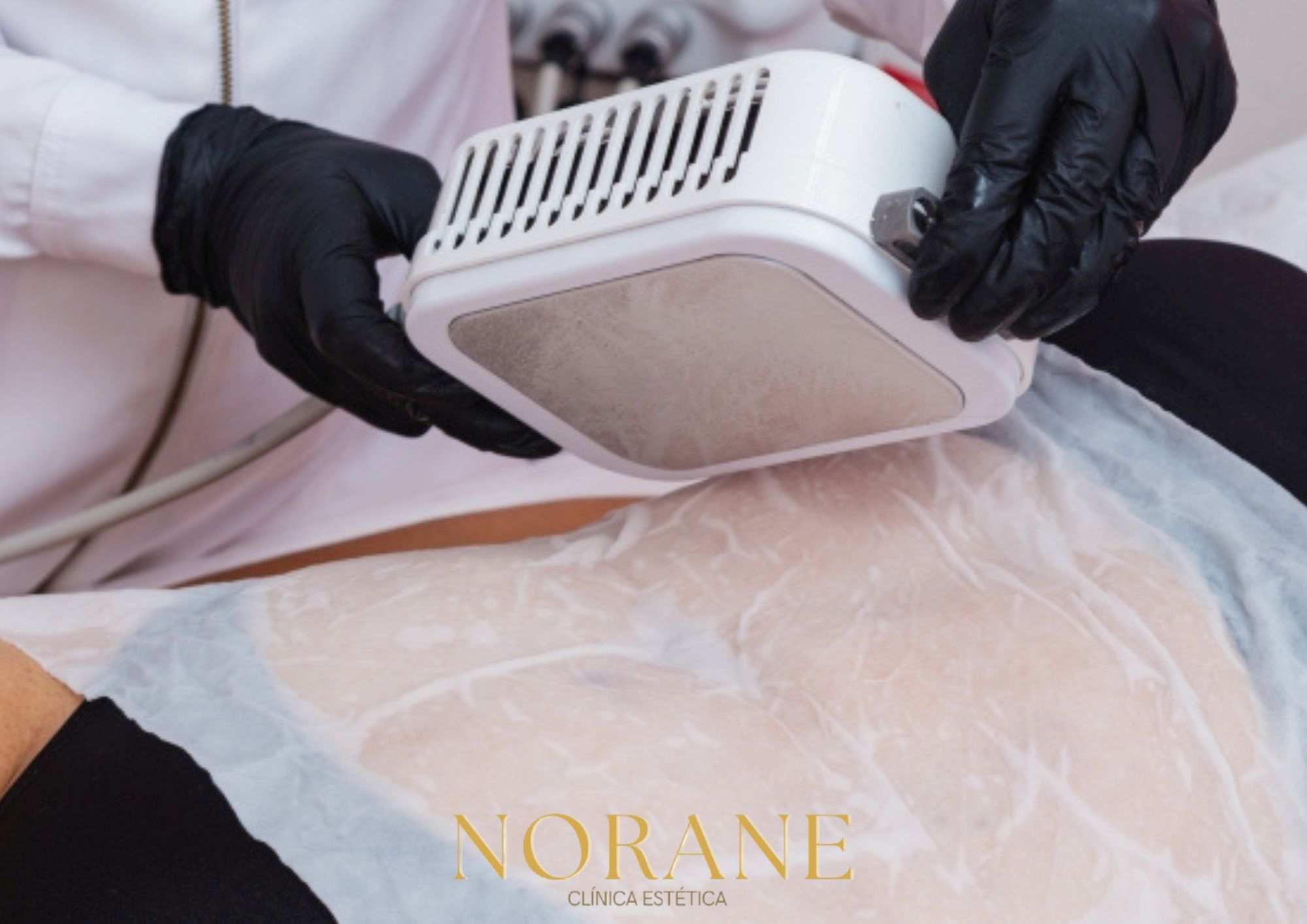 Criolipolise 3 Placas + Massagem Modeladora